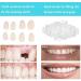 Temporary Tooth Repair Kit - Moldable Fake Teeth & Thermal Beads Replacement (Size 1) - Buy Online on GoSupps.com