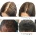 Organic Saw Palmetto Oil | Prostate Health Support | DHT Blocker | Hair Loss Prevention | 60-90 Day Supply (1 Fl Oz) - Buy Online on GoSupps.com
