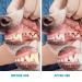 Pack of 4 Finger Toothbrushes for Dogs - Dental Care for Small Medium & Large Breeds - Buy Online on GoSupps.com