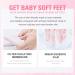 Rose Foot Peel Mask For Hard Skin Rose Foot Peel Mask Rose Foot Mask Exfoliating Feet Peeling Socks Foot Care Mask Plant Formula Moisturising Socks Foot Spa Fits for Women and Men(2 Pairs) - Buy Online on GoSupps.com