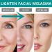 Cr me pour le visage Melasma Taches de rousseur Cr me r novatrice pour la peau fonc e Cr me cosm tique pour le visage peau noire Yunnan Japanese Melasma Cream For All Skin Types (1pcs) - Buy Online on GoSupps.com