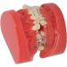 Orthodontic Model 24 Teeth with Metal Wire Case - Ideal for Dental Hospitals | International Shipping Available - Buy Online on GoSupps.com
