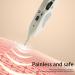 Solomi Acupuncture Pen | Electronic Digital Acupuncture Device for Optimal Health - International Shipping Available - Buy Online on GoSupps.com