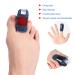 Toe Straighteners - Ergonomic Claw Toe Fixation Corrector for Fracture Recovery - Buy Online on GoSupps.com