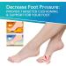 Metatarsal Pads & Toe Separator Set (3 Pairs) | Bunion Corrector & Toe Straightener | For Men & Women - Buy Online on GoSupps.com