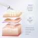 Skin Scrubber Blackhead Remover Set | COSBEAUTY Skin Spatula Exfoliating Scraper with Blackhead Power Liquid | Wireless Charging | IPX6 Waterproof - Buy Online on GoSupps.com