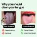 Mintier Tongue Scraper - 100% Rust Resistant Stainless Steel Cleaner (2-Pack) for Improved Oral Hygiene and Fresh Breath - Dishwasher Safe - Buy Online on GoSupps.com