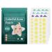 Star-Shaped Pimple Patch Small Hydrocolloid Acne Stickers Comfortable Acne Absorbing Cover Patch for Face Back Acne Dots Blemish Pimples Whiteheads 112 Patches