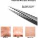 ZIZZON Pointed Tweezers Precision - Ingrown Hair & Blackhead Remover for Women and Men - Buy Online on GoSupps.com