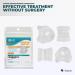 5 Stars United Bunion Corrector and Relief Sleeve - 2-Pack + Toe Separators - 4-Pack Bundle - Buy Online on GoSupps.com
