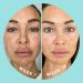 ZitSticka Blur Potion: Vitamin Supplement for Hyperpigmentation, Melasma & Dark Spots - 30 Caps - Buy Online on GoSupps.com
