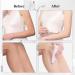NEWDERMO Body Microdermabrasion Exfoliator Machine - Professional Suction Diamond Dermabrasion Device - Home Body Treatment Tool - Buy Online on GoSupps.com