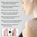 Vitiligo Removal Relief Spray - Reduces White Spots on Skin - 3pcs - Buy Online on GoSupps.com