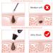 Blackhead Remover Pore Vacuum with Camera - Acne Extractor, Hot Compress, WiFi HD Camera, 4 Probes, 3 Adjustable Suction, USB Rechargeable | Suitable for All Skin Types - Buy Online on GoSupps.com