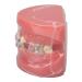 Verdant Touch Orthodontic Demonstration Model Orthodontic Dental Model Dissected Resin Teeth Model for Teaching Research