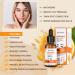 Buy Vitamin C Serum for Face - Brightening Anti-Aging Acne & Dark Spot Treatment | 30ml Moisture Facial Serum - Buy Online on GoSupps.com