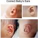 Lantro JS Silicone Ear Corrector for Newborns and Kids - Protruding Ear Patch Stickers for Babies - 4 x 50cm - Buy Online on GoSupps.com