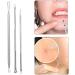 Froiny 3-Piece Blackhead Remover Tool Kit | Acne Comedone & Pimple Extractor | Effective Whitehead & Ingrown Hair Tweezers for Bridal Spot Treatment - Buy Online on GoSupps.com
