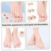 Lurrose 8 Pairs Gel Toe Separators for Men and Women - Bunion Correctors & Foot Care Supplies - Thumb Protector & Toe Dividers - Buy Online on GoSupps.com
