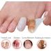 Mcvcoyh 18 Pieces Pinky Toe Caps Breathable Toe Protector Small Toe Cover Sleeves with Holes Provides Relief from Corns Blisters Sores - Buy Online on GoSupps.com