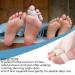 24 Pieces Toe Separators & Bunion Corrector - Soft Gel Big Toe Spacers for Bunion Relief & Overlap Toes - International Shipping Available - Buy Online on GoSupps.com