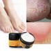 AllbestAye Foot Repair Skin Healing Cream for Thick Cracked Rough Dead Dry Skin Moisturizing Callus Care for FEET Elbows Hands Exoliating Foot Cream for Cracked Heels And Dry Feet 50g
