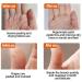 Yutingchby Natural Winter Anti-Cracking Frost - 100% Natural Moisturizing Foot Cream for Rough Dry and Cracked Hands - Buy Online on GoSupps.com