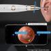 QIYUDS Wireless Otoscope Ear Wax Remover Kit - HD Portable Ear Camera with LED Light for Visual Ear Cleaning - Includes Ear Spoons - Pink - Buy Online on GoSupps.com