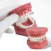 TM-208 Orthodontic Model Teeth - Study Tools with Metal & Ceramic Bracket (Red) for Effective Teaching | International Shipping Available - Buy Online on GoSupps.com