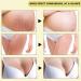Natural Rose Stretch Mark Cream for Pregnancy - Effective Scar Removal & Prevention | 40g Body Moisturizer - Buy Online on GoSupps.com