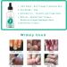 Kerassentials Toenail Fungus Treatment Oil Best Repair Solution for Fingernails and Toenails Fix & Renew Damage Fungal Nail Broken Cracked & Discolored Nails - Buy Online on GoSupps.com