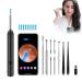 Ear Wax Removal Ear Cleaner with Camera Ear Wax Removal Kit with 1080P Ear Camera Otoscope with Light 360 Wide Angel Ear Cleaning Kit for iPhone iPad Android Phones (Black)
