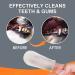 100Pcs Dog Teeth Cleaning Finger Wipes | Pet Dental Care | Freshen Breath, Reduce Plaque & Tartar | No Brushing Required - Buy Online on GoSupps.com