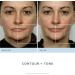 Nuface Trinity Starter Kit - Ultimate Facial Toning Device for Radiant Skin | Fast International Shipping - Buy Online on GoSupps.com