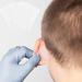Invisible Tape 30Pcs for Prominent Ears - Ear Corrector Valgus Aesthetic Correctors, Ear Patch Stickers for Big Ear Problem - Ear Correction Solution - Buy Online on GoSupps.com