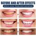 Aiposhiy Teeth Whitening Powder - Natural Mint Probiotic Tooth Cleaning Powder (3PCs) - Brighten Your Smile Naturally! - Buy Online on GoSupps.com