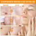 Gel exfoliante de naranja natural Orange Exfoliant Gel Gel Exfoliant Orange gel blanqueador naranja brillante nutre e hidrata reduce las arrugas y elimina las manchas oscuras (2 unidades) - Buy Online on GoSupps.com