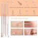 DUcare Blackhead Remover Kit - 4Pcs Professional Stainless Steel Acne Extraction Tools (Gold) - Buy Online on GoSupps.com