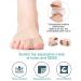 BLATOWN Toe Spacers for Bunion Correction - 2 Pair Set with Elastic Toe Loops and Soft Gel Pads (S+L) - Buy Online on GoSupps.com