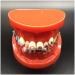 Dytah toothpodont with mental brackets orthodontic teeth model with ligature ties red orthodontic model Teach study tools for study