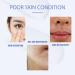 Ceramide Moisturizing Face Cream - Moisturiser Face Women - Anti aging Face Cream for Women - Deeply Nourishes Skin - Skin Lightening Cream - Light Texture and Easy Absorption - Buy Online on GoSupps.com