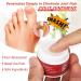 Yagerod Urigone Healing Ointment for Gout - Pain Relief Cream (3 x 10g) | Relieve Gout & Balance Discomfort International Shipping - Buy Online on GoSupps.com