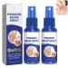 Aitontl Psoriasis Treatment Spray New Zealand Professional Psoriasis Treatment Spray Soothing and Moisturizing Psoriasis Cream Psoriasis Treatment for Skin (Color : 2pcs)
