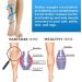 Medical Compression Stockings 20-30 mmHg for Men & Women - Gradient Support for Varicose Veins & Circulatory Health | XXL Beige - Buy Online on GoSupps.com