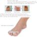 5-Hole Toe Separator & Stretcher for Hallux Valgus Correction - Prevent Corns & Calluses, Improve Foot Strength - Men & Women Care | 1 Pair - Buy Online on GoSupps.com