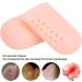01 Gel Toe Caps - Pain-Relieving Portable Toe Covers with Holes for Ingrown Toenails & Chicken Eyes - Bubble Bl Color | International Shipping - Buy Online on GoSupps.com