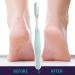 Pedicure Foot File Toe Crevice Cleaning Brush Shower Foot Scrubber Skin Removal Foot File Callus Remover Long Handled Toe Brush for Wet and Dry Feet Blue - Buy Online on GoSupps.com