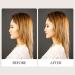Facelifting Tape Bands - Reusable Face Lifting Bands with Clips for Chin Neck & Eyes | 2 Pieces - Best Invisible Hair Bands for Youthful Appearance - Buy Online on GoSupps.com