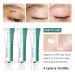 MIESCHER Acne Scar Removal Cream - Moisturizing Repair Gel for Face Pimples, Stretch Marks & Burn Scars - Acne Removal Treatment for Damaged Skin - Buy Online on GoSupps.com