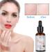 Snail Repair Eye Cream | Anti-Aging Essence Serum for Face & Eyes | Moisturizing Dark Circle Reducer with Snail Mucus Extract - Buy Online on GoSupps.com